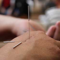 Traditional-Chinese-Acupuncture-Certificate-Courses
