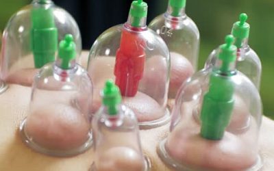 Higher Diploma in Hijama Cupping Therapy Full Course