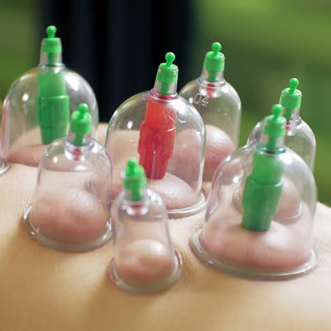 Accredited Higher Diploma in Hijama Cupping Therapy Course